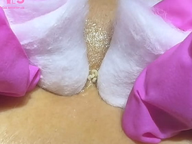 Extração de cravos e espinhas asian girl gay sex videos