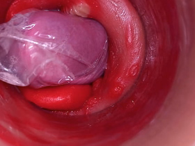 The camera inside the deep pussy records a huge ejaculation with a stuck condom chubby asian gay sex videos