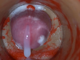 Insemination - Domestic Camera Captures Deep Be ahead of Ejaculation asian hard undignified gay sexual congress videos